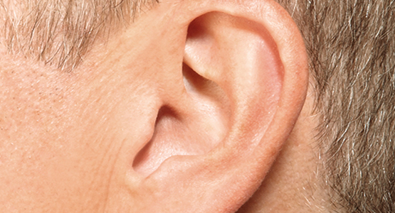 Inside-the-ear - Invisible - Dilworth Hearing